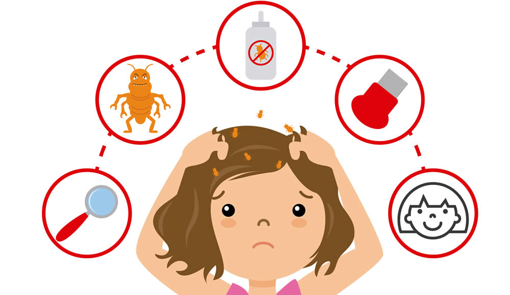 Shampoo per Pidocchi - Efficacia e Guida all'Acquisto