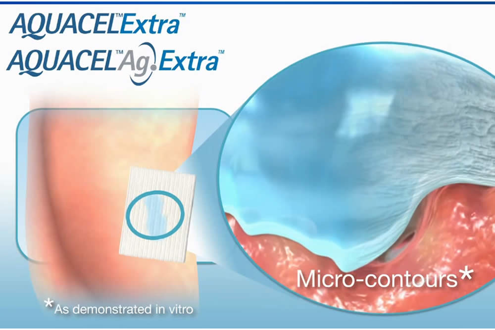 Aquacel Ag+ Extra - Medicazione: Come Funziona? Uso e Opinioni 2019