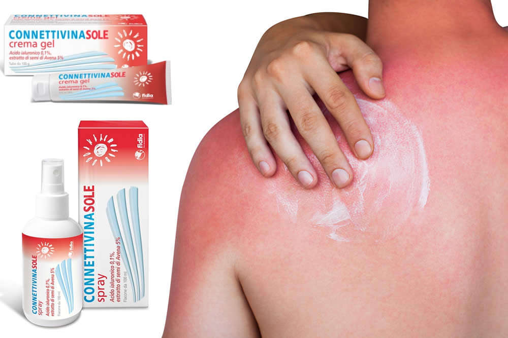 Connettivina Sole 2019 - Crema Scottature Solari: Uso, Prezzo, Opinioni