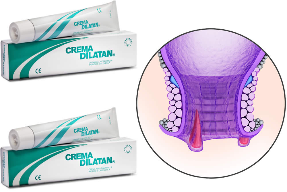 Dilatan Crema 2019 - Crema Emorroidi e Ragadi - Funziona? Opinioni