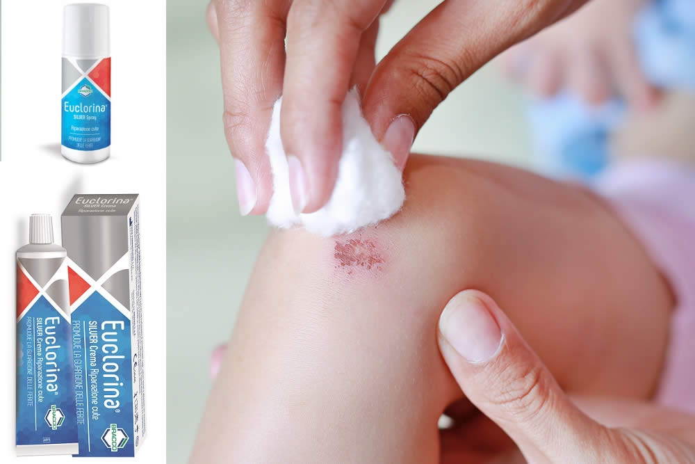 Euclorina 2019 - Crema e Spray per Ferite Cutanee - Uso e Opinioni