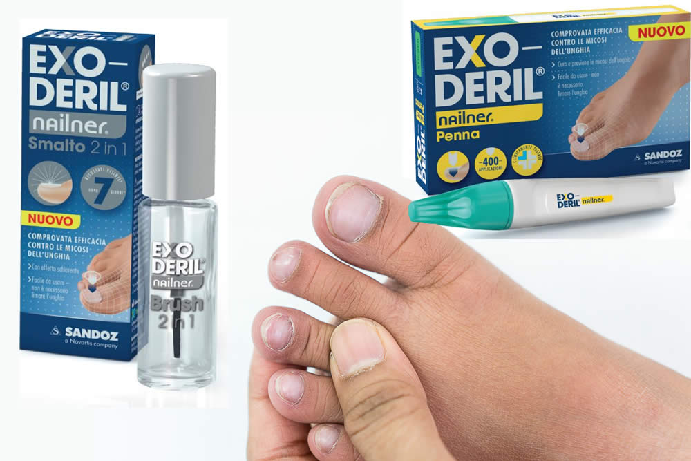 Exoderil 2019 e Micosi delle Unghie: Funziona? Fa Male? Opinioni