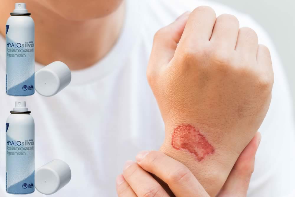 Hyalosilver 2019 - Spray Cicatrizzante - Benefici, Uso e Opinioni