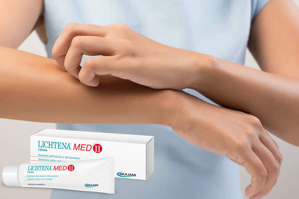 Lichtena Med 2019 - Crema Dermatiti - Benefici, Uso, Prezzo e Opinioni