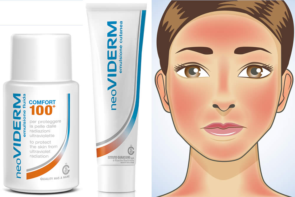 Neoviderm 2019 - Crema Scottature e Arrossamenti: Funziona? Opinioni